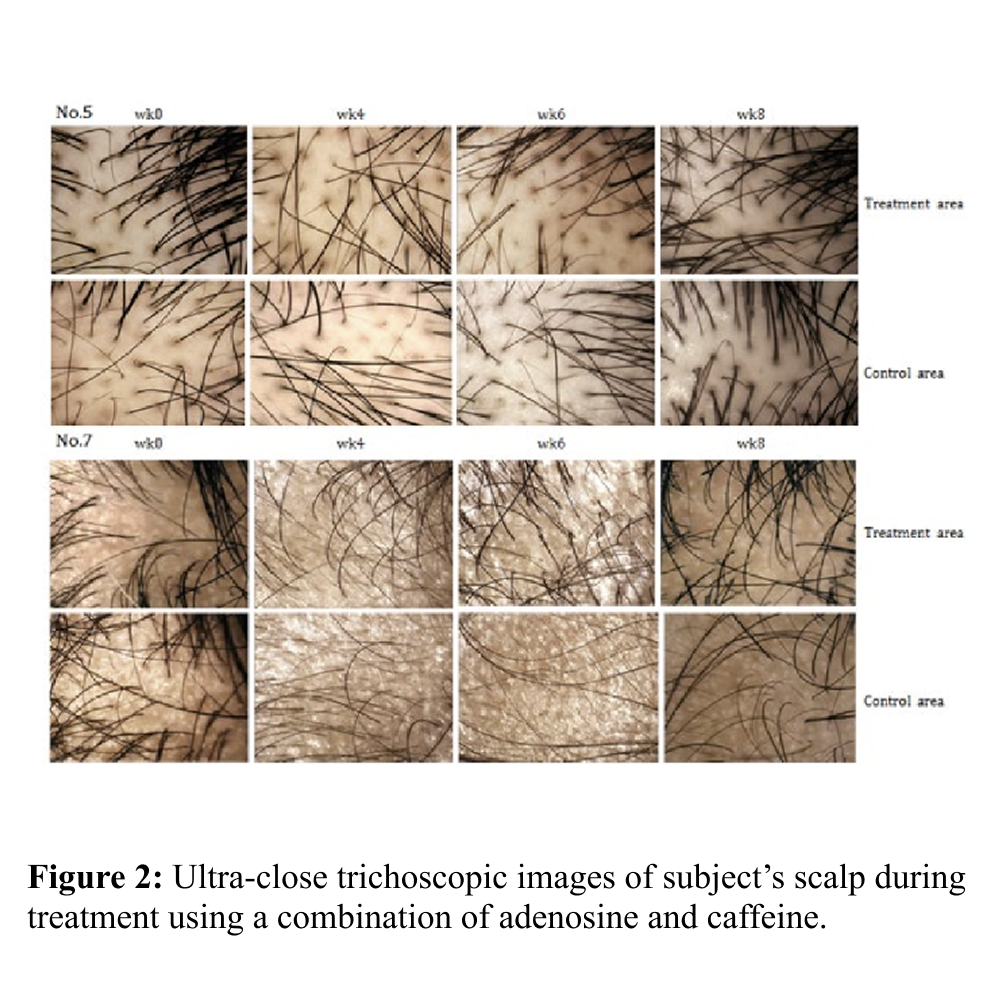 Caffeine Is Clinically Proven To Grow Longer Hair Naturally