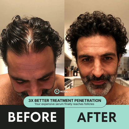 Regen 2 - in - 1 Shampoo & Conditioner (Men) - NovaMane