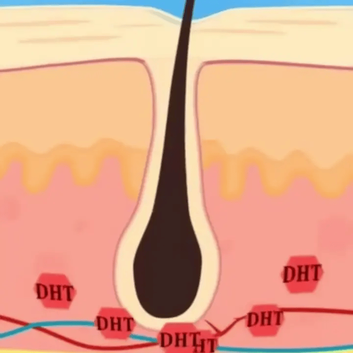 Why Nothing In The Hair Loss Industry Was Built for Guys on TRT: